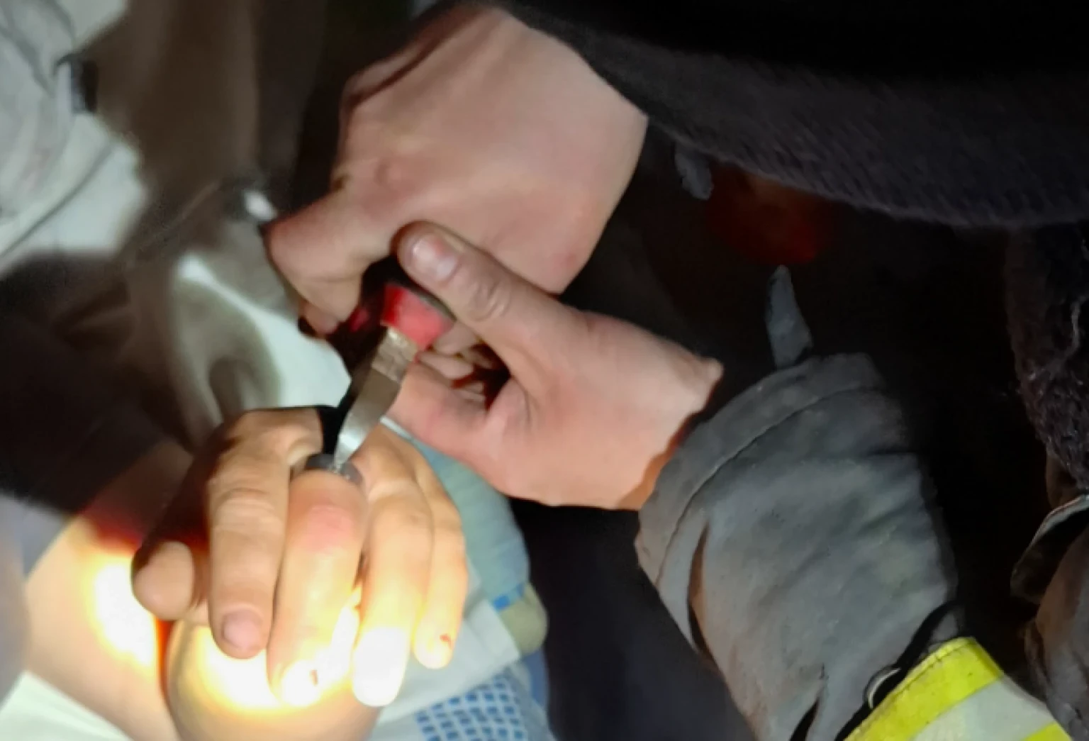 У Шаргородській громаді рятувальники визволили жінку з металевої пастки на пальці