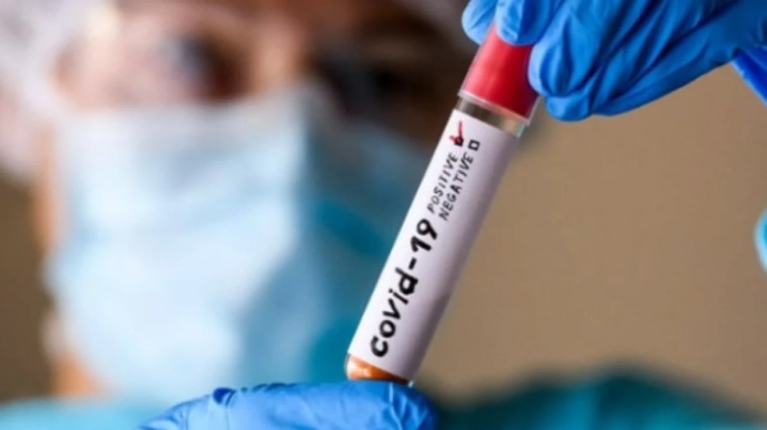 У Вінницькій області зафіксували субваріант COVID-19 «Цикада»: фахівці пояснили рівень небезпеки